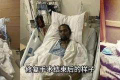KD最奇！科比、杜蘭特、塔圖姆跟腱斷裂修復(fù)手術(shù)結(jié)束后的樣子