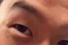 脑门肿了！孙兴慜被人推撞到了奖杯，但孙哥高兴得合不拢嘴